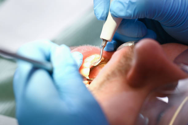 Best Emergency Gum Pain Relief  in Dahlgren, VA