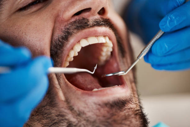 Best Broken Tooth Emergency  in Dahlgren, VA