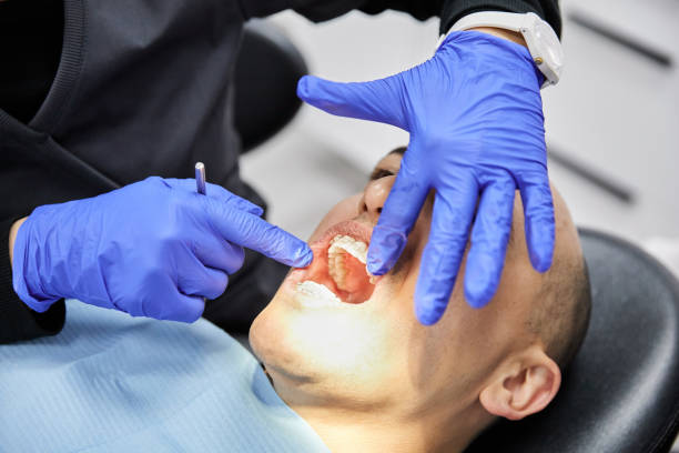 Best Teeth Whitening  in Dahlgren, VA