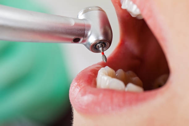 Best Dentist for Dental Trauma  in Dahlgren, VA